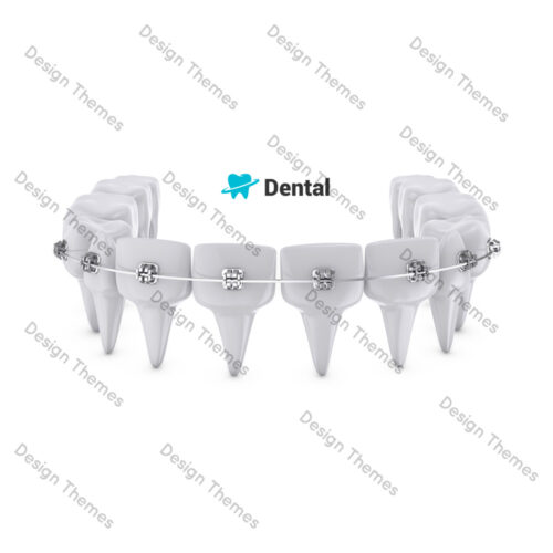 Braces